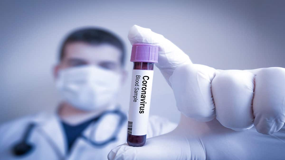 images/noticias/1623842931-coronavirus1.jpg